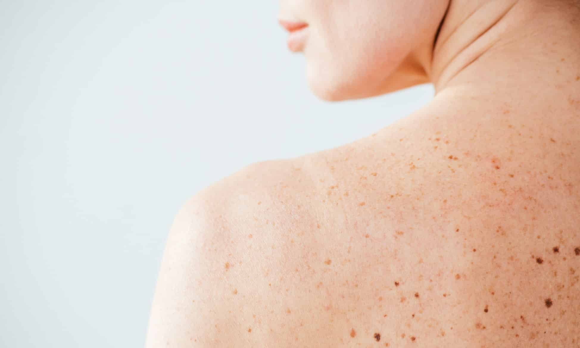 Dermatologie